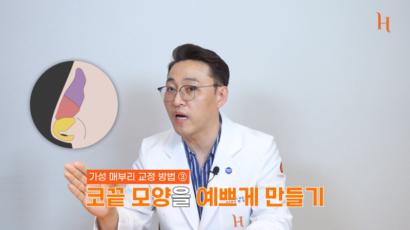 매부리코도 자라난다? 메부리 원인 사진 14