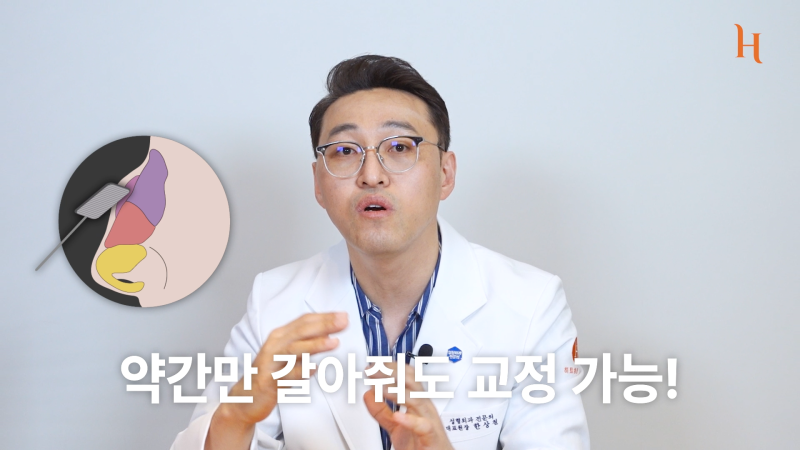 매부리코도 자라난다? 메부리 원인 사진 9