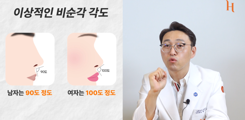 중안면부를 개선하는 인중각도 (비순각 교정, 고양이수술) 사진 6