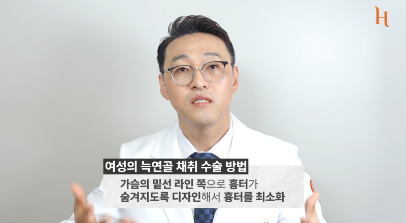 갈비뼈로 하는 코수술? (자가늑코성형)