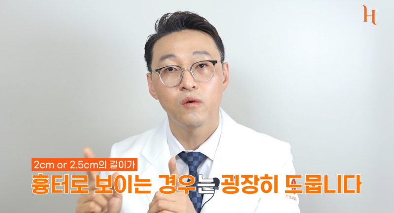 갈비뼈로 하는 코수술? (자가늑코성형) 사진 10
