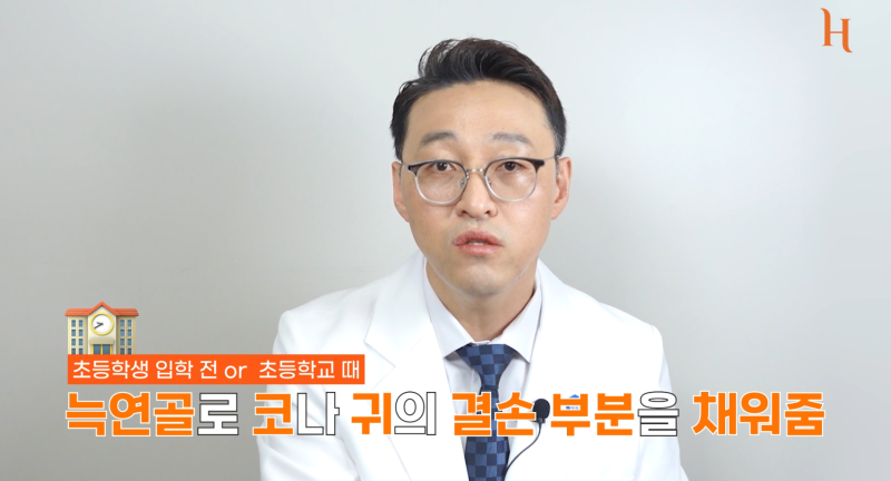 갈비뼈로 하는 코수술? (자가늑코성형) 사진 3