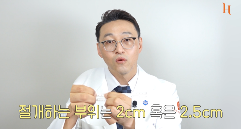 갈비뼈로 하는 코수술? (자가늑코성형) 사진 8
