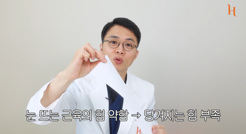 내 눈에 소시지? 쌍꺼풀 망하신 분..? 사진 10