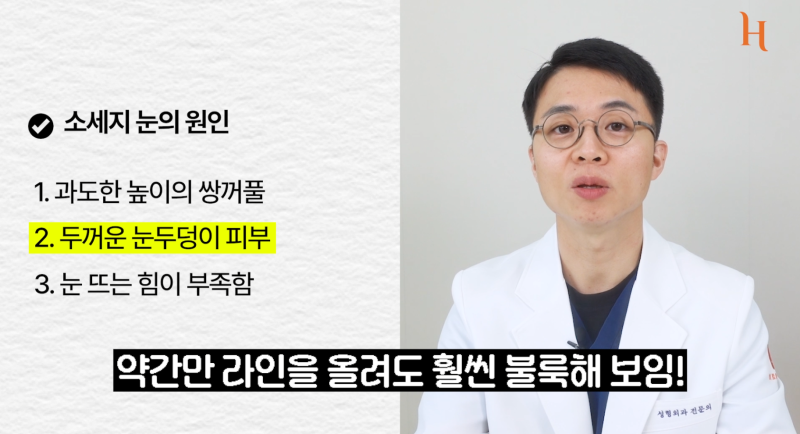 내 눈에 소시지? 쌍꺼풀 망하신 분..? 사진 6