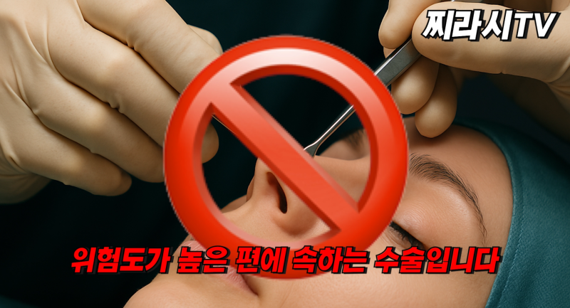 성형찌라시 하면 안되는 수술? 사진 4
