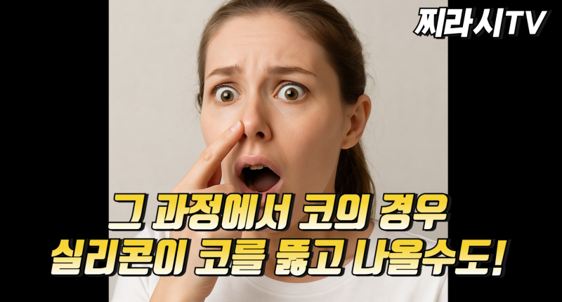 성형찌라시 하면 안되는 수술? 사진 18
