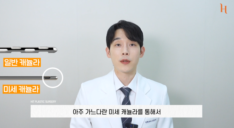 바이오본드 얼굴지방흡입 후 증상 사진 9