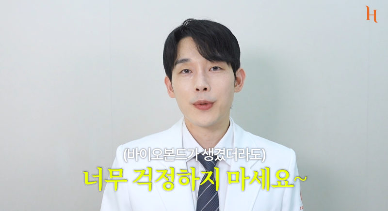 바이오본드 얼굴지방흡입 후 증상 사진 11