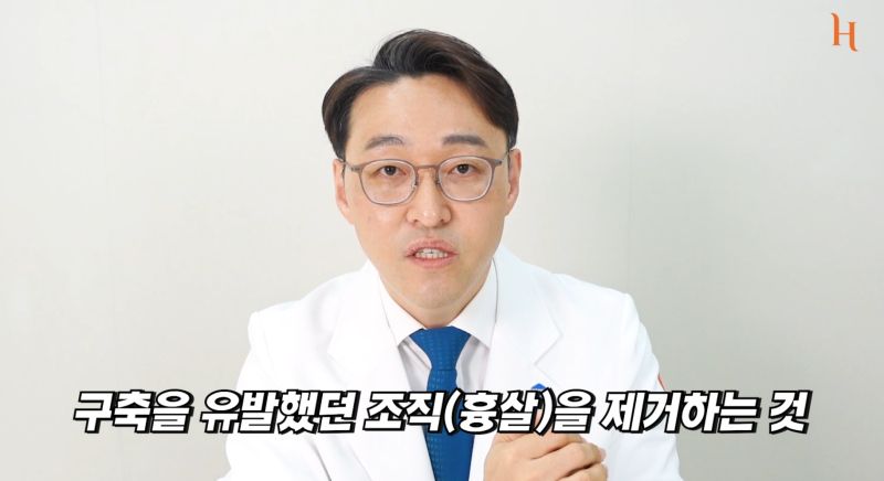 구축코를 예방하는 완벽한 방법은 없다? 사진 10