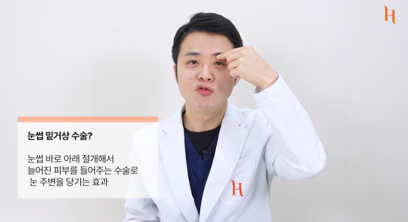 눈겹주름 쌍꺼풀이 아닙니다 사진 8