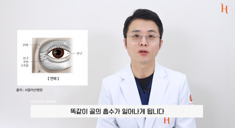 눈위지방이식 꺼진눈 해결 방법 사진 2