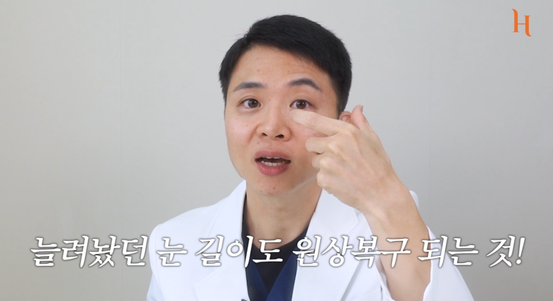 뒤트임 후 ㄷ 흉터 사진 7