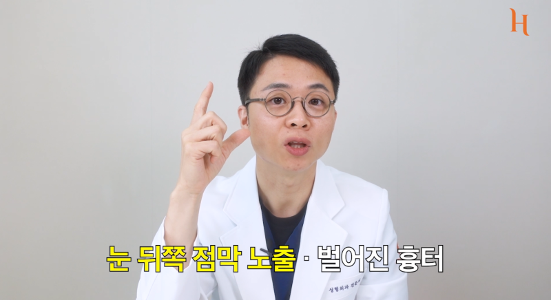뒤트임 후 ㄷ 흉터 사진 3