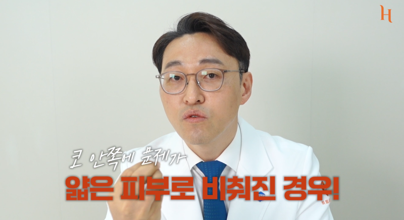 코수술 후 위험한 증상 9가지! 사진 16