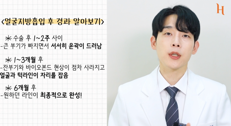 얼굴지방흡입 효과 보는 방법 사진 13