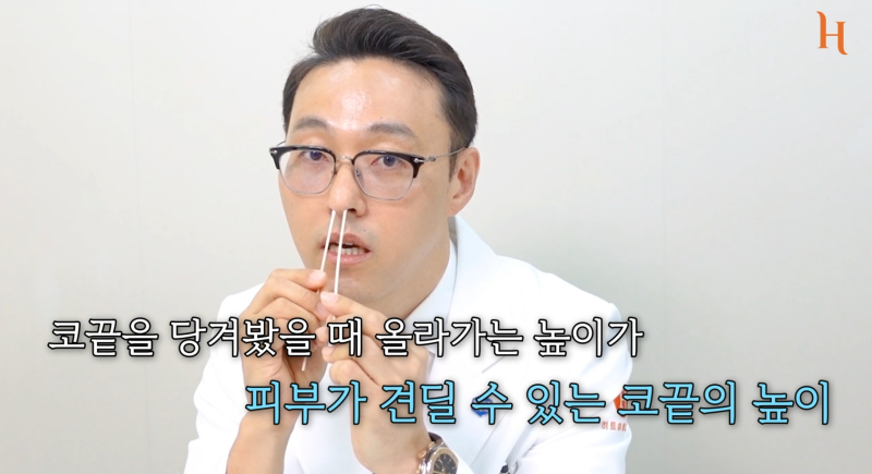 코재수술 하는 이유? 사진 7