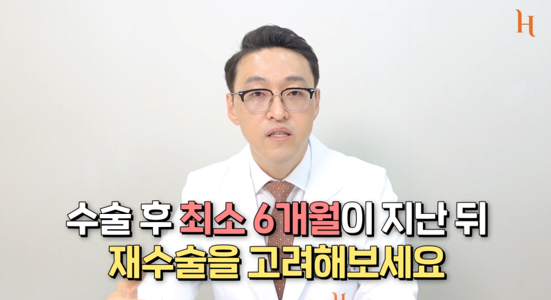 코재수술 잘하는 꿀팁 사진 7