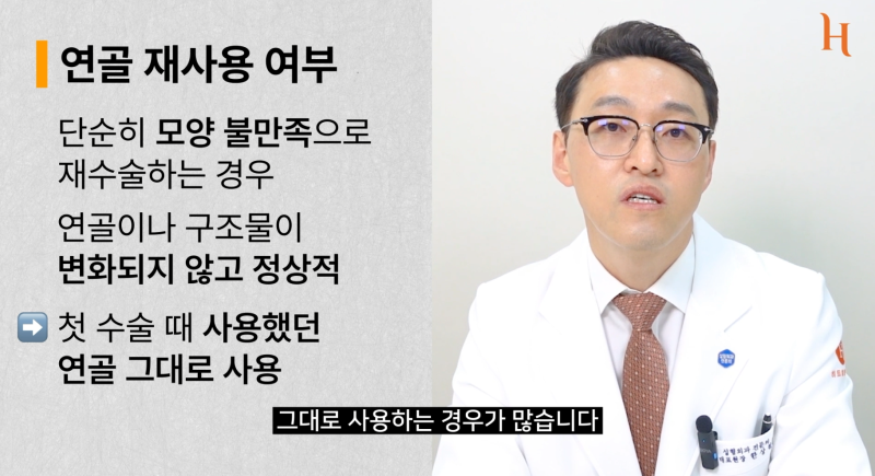 코재수술 잘하는 꿀팁