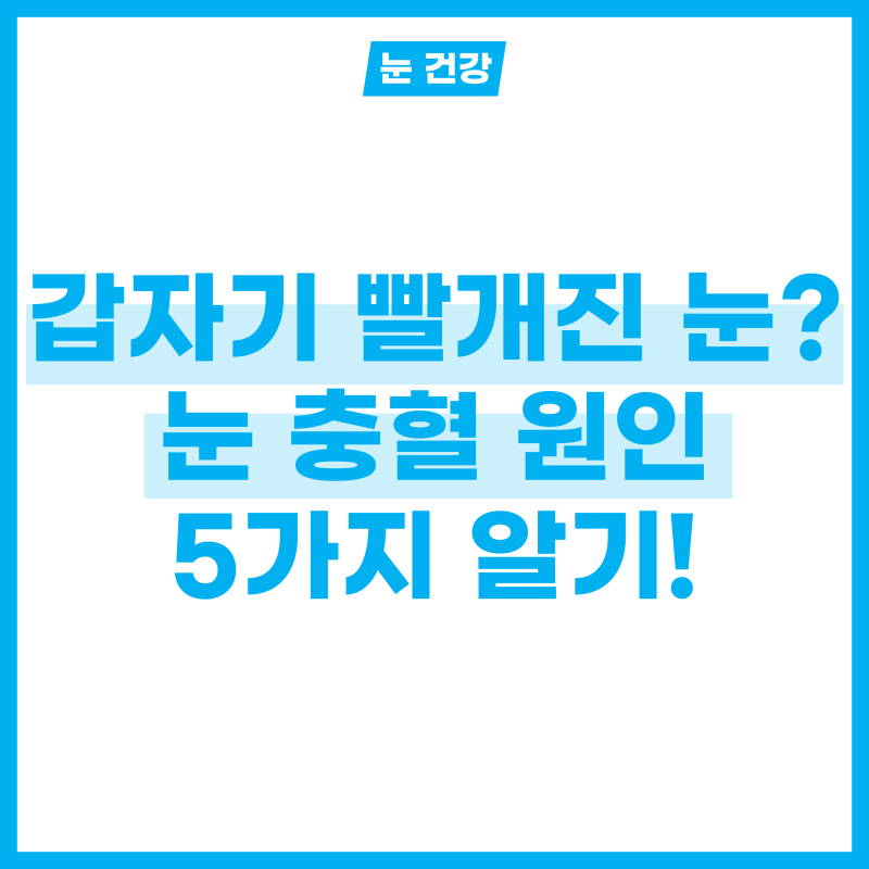 "갑자기 빨개진 눈?" 눈 충혈 원인 5가지 알아보기!