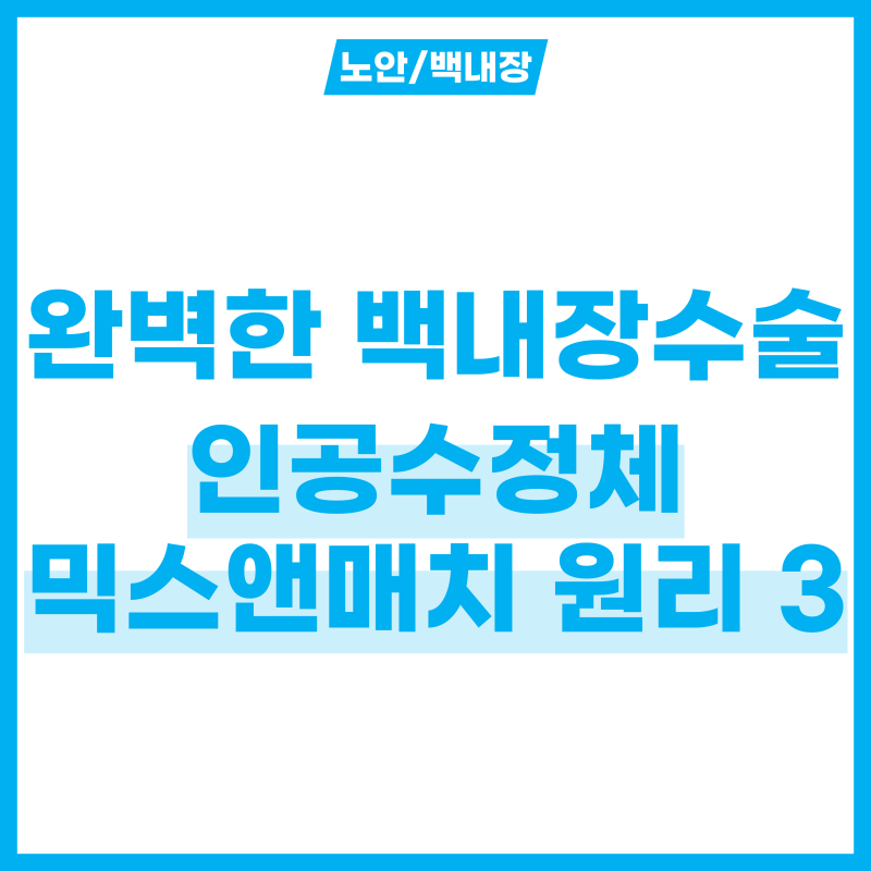 인공수정체 믹스앤매치로 완벽한 백내장 수술 하는 3가지 원리