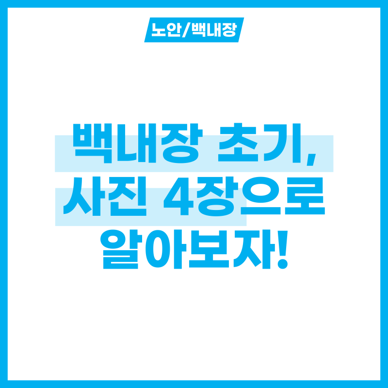 사진 4장으로 알아보는 백내장 초기! 백내장 렌즈 비교까지