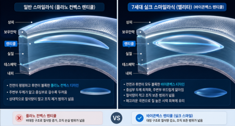 7세대 실크SILK 스마일라식 장점 vs. 기존 다른 스마일라식