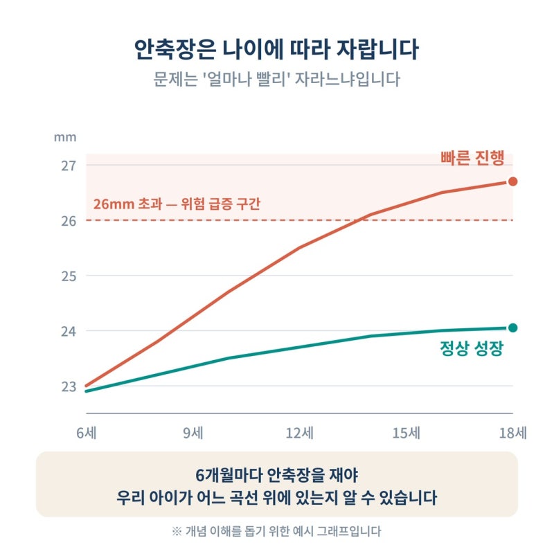 아이 시력 0.7 나왔다면? 초등학생 근시, 안경보다 먼저 확인할 것 사진 4