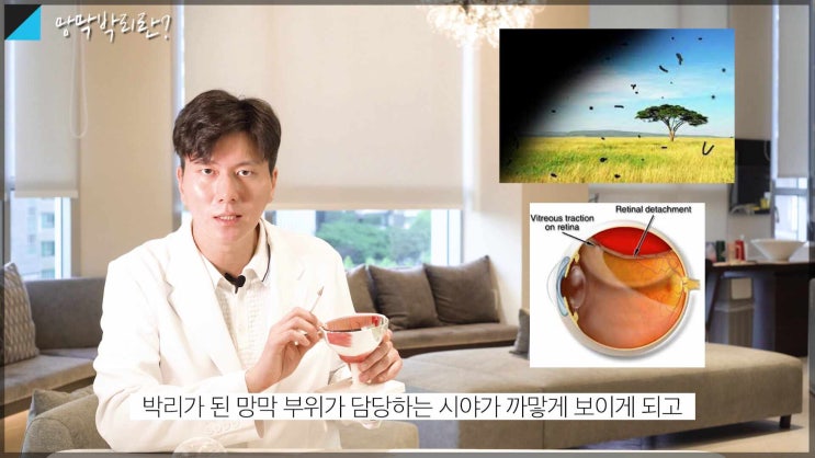망막박리! 응급수술! 에 대하여 성모 진안과 박진형 대표원장이 설명 드립니다