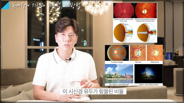 녹내장🤢 시야가 좁아져서 실명할 수도?! 강남역 성모 진안과 박진형 대표원장이 쉽고 자세하게 설명해 드립니다 [진짜 안과] [성모 진안과]