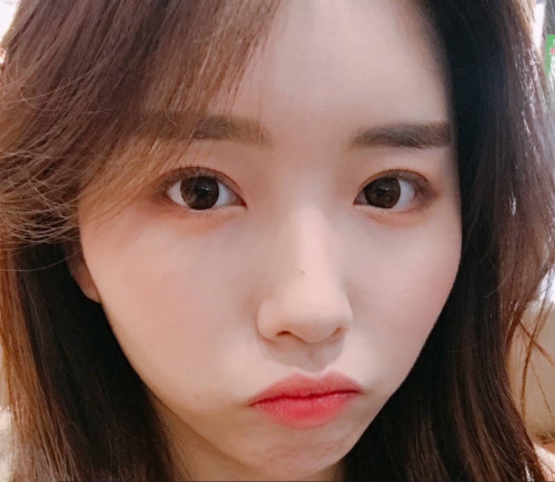 눈매교정 수술로 아름다운 눈모양 만들기 - 절개·비절개 방법 비교