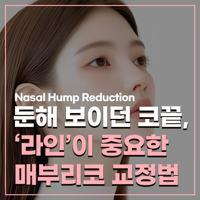 매부리코 코끝수술로 완성하는 자연스럽고 세련된 라인 - 코원성형외과