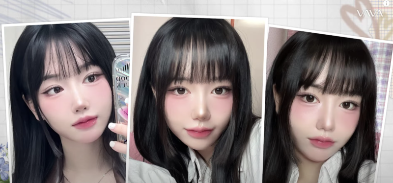 졸려보이는 눈 자연유착 밑트임 위트임으로 또렷하게 (리얼 후기)