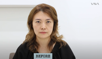 A 50-something mom's second prime: Real review of middle-aged eye surgery, lower blepharoplasty, and forehead lift