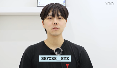 Eye and Contracted Nose Revision Surgery Review | Why a Man's Eye and Nose Revision Surgery Changed at Apgujeong VAVA
