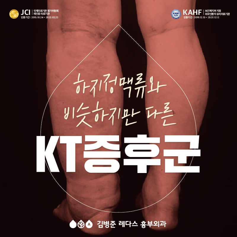 하지정맥류와 비슷하지만 다른 KT 증후군