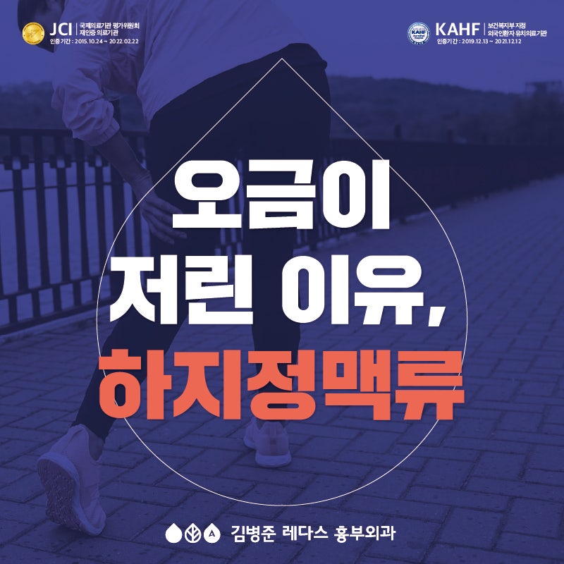 하지정맥류와 오금 통증