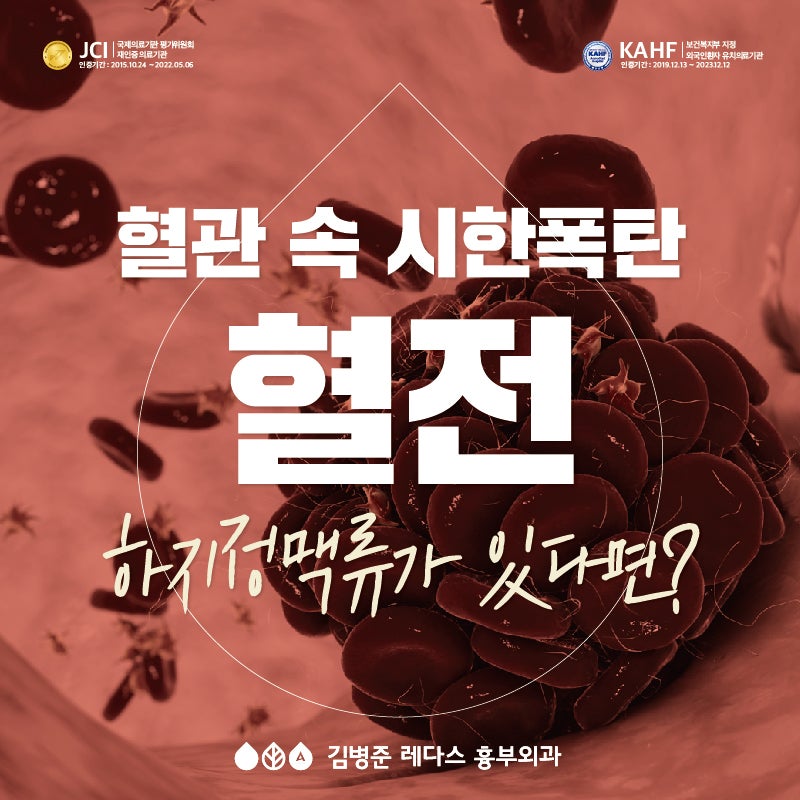 혈관 속 시한폭탄 '혈전', 하지정맥류 있다면 주의!