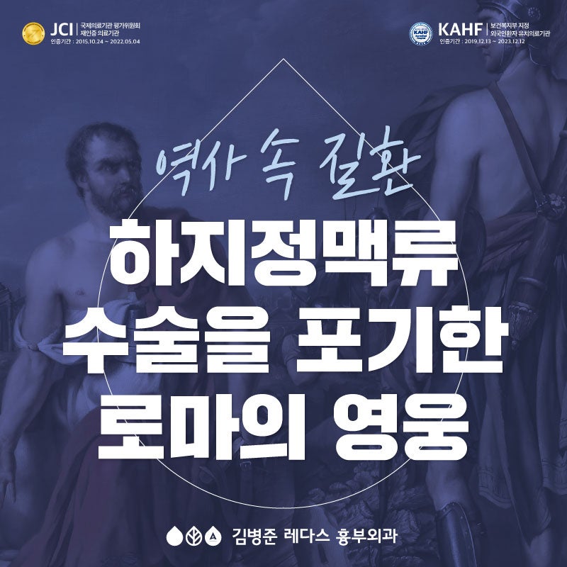 [역사 속 질환] 하지정맥류 수술을 포기한 로마의 영웅