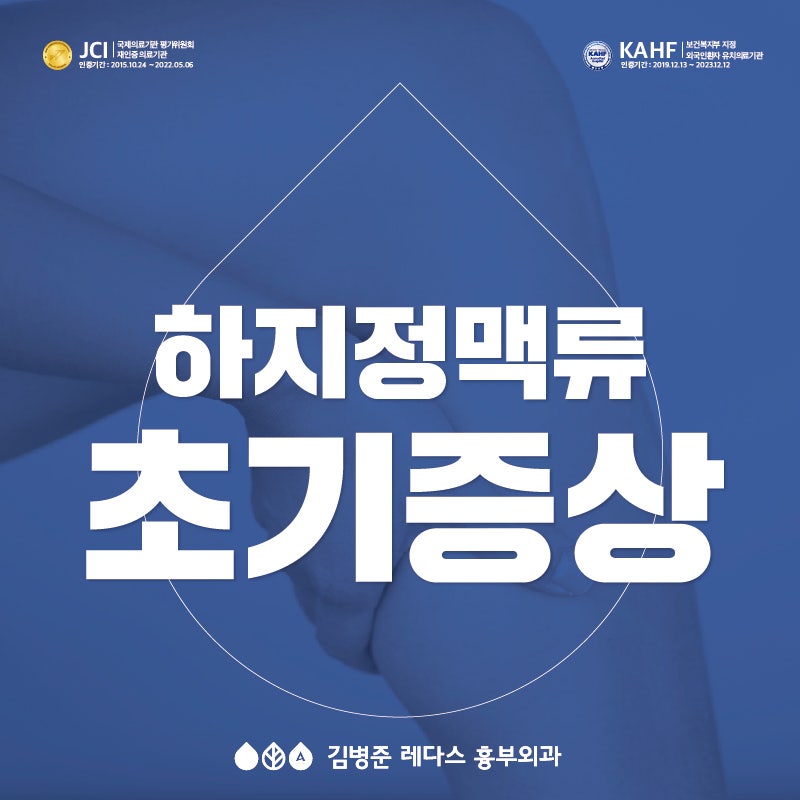 서면 하지정맥류 - 하지정맥류 초기 증상