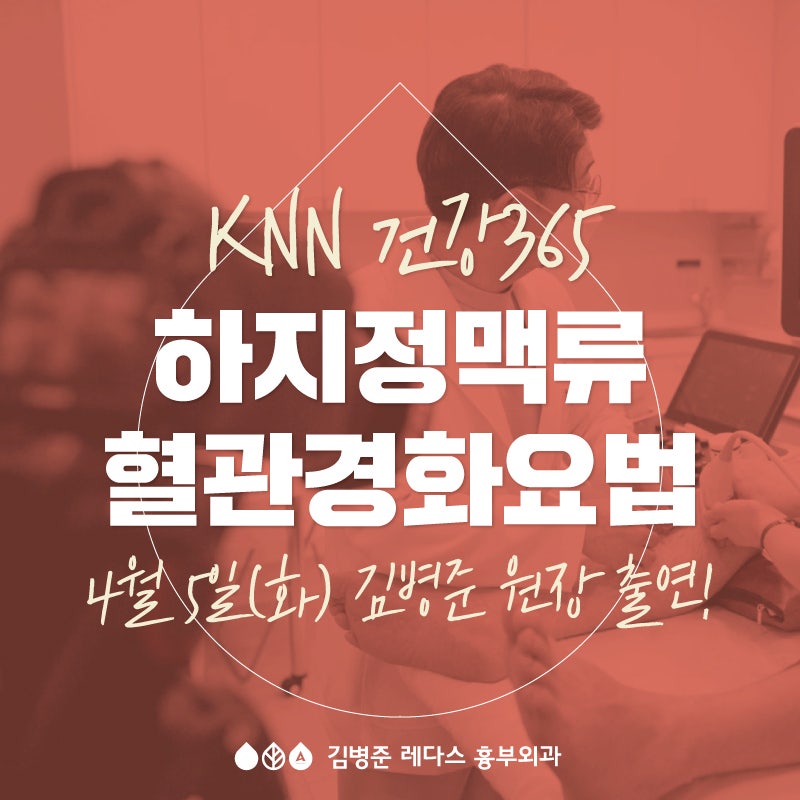 [KNN 건강365] 악화되는 하지정맥류, 주사요법으로 치료!