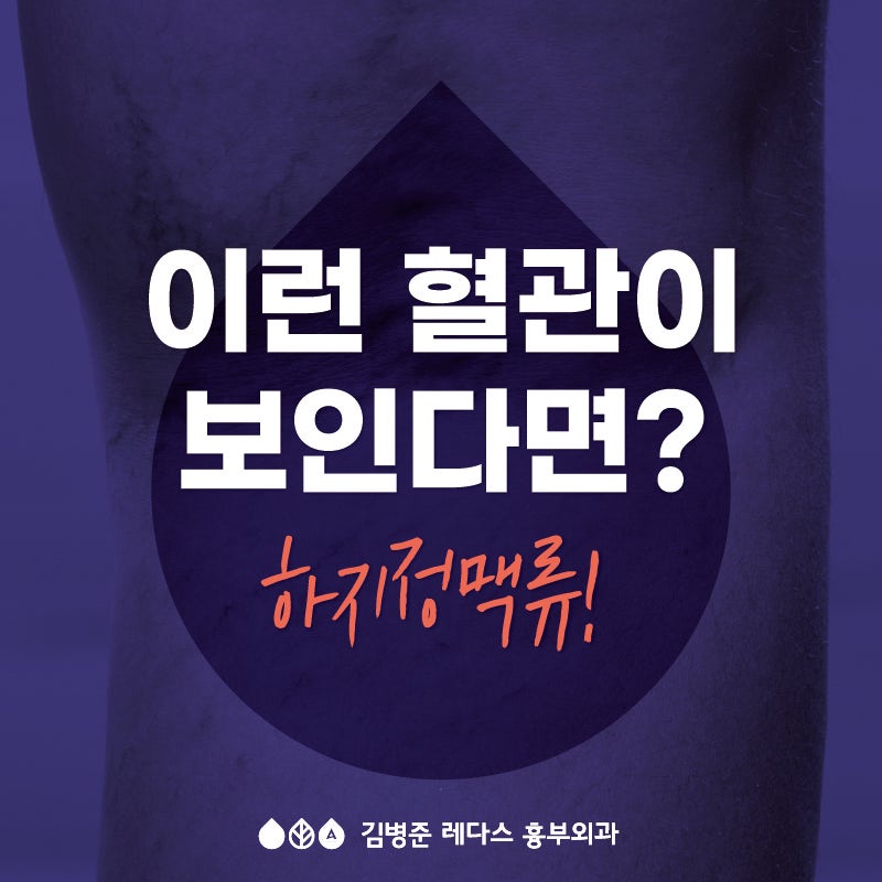 [부산 하지정맥류] 이런 혈관이 보인다면? 하지정맥류!