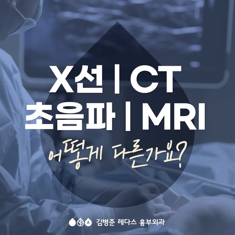 X-ray, CT, 초음파, MRI 비교 : 하지정맥류 검사는?