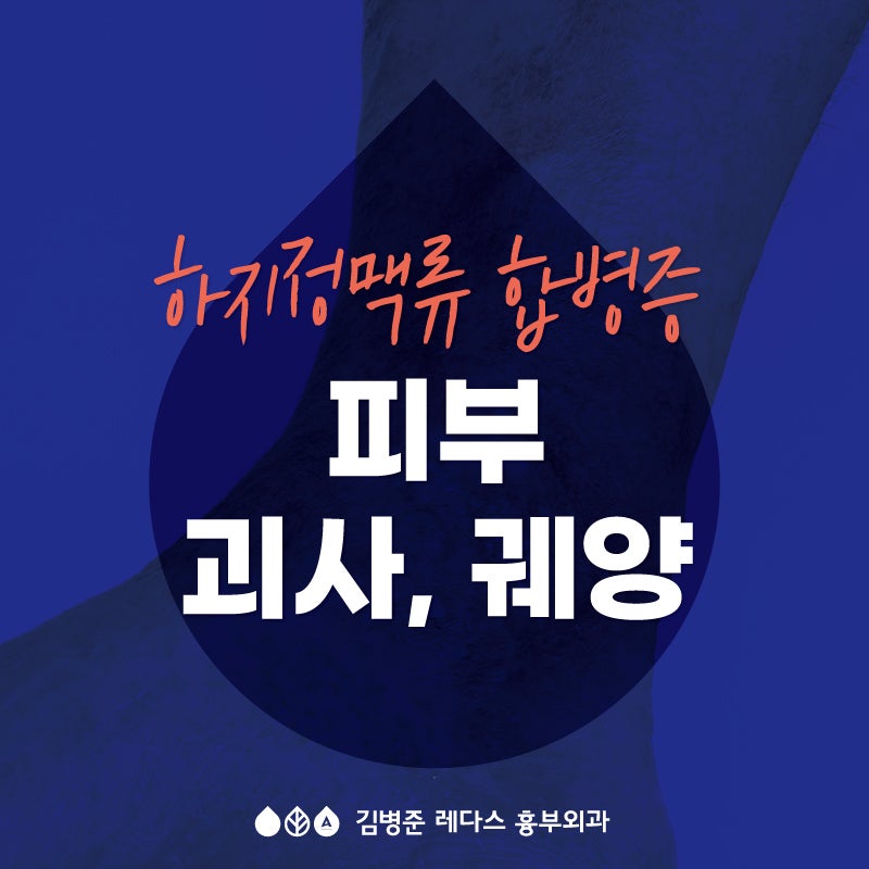이런 증상이 나타난다면 빨리 병원에 가세요! 하지정맥류 합병증