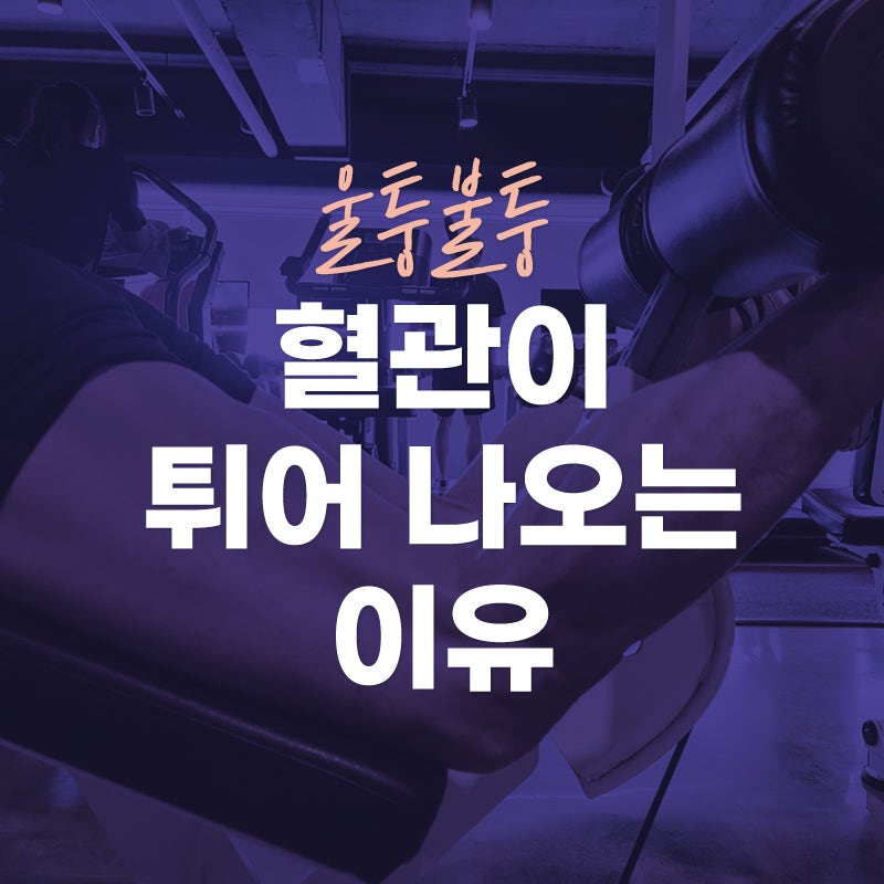 (서면 하지정맥류) 혈관이 튀어나오는 이유