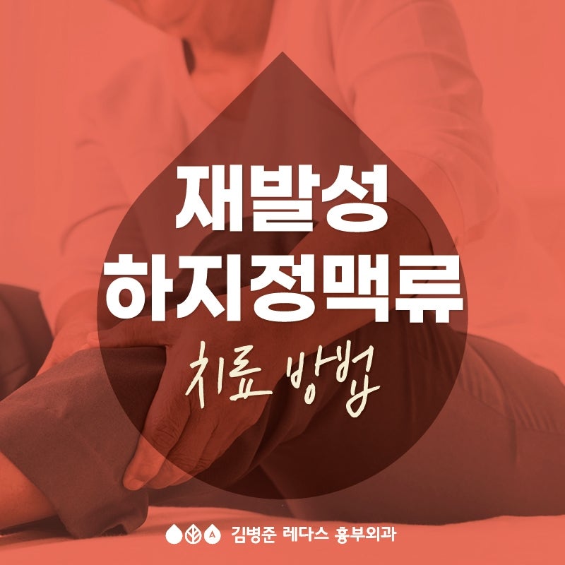 (흉부외과 전문의) 재발성 하지정맥류 치료