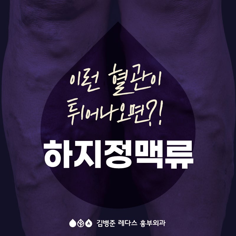다리에 혈관이 튀어나왔어요
