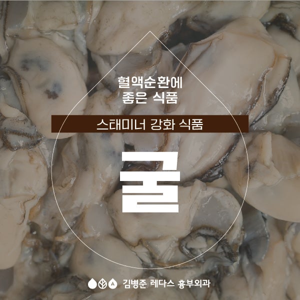 혈액순환에 좋은 음식 ‘굴’ + 노로바이러스