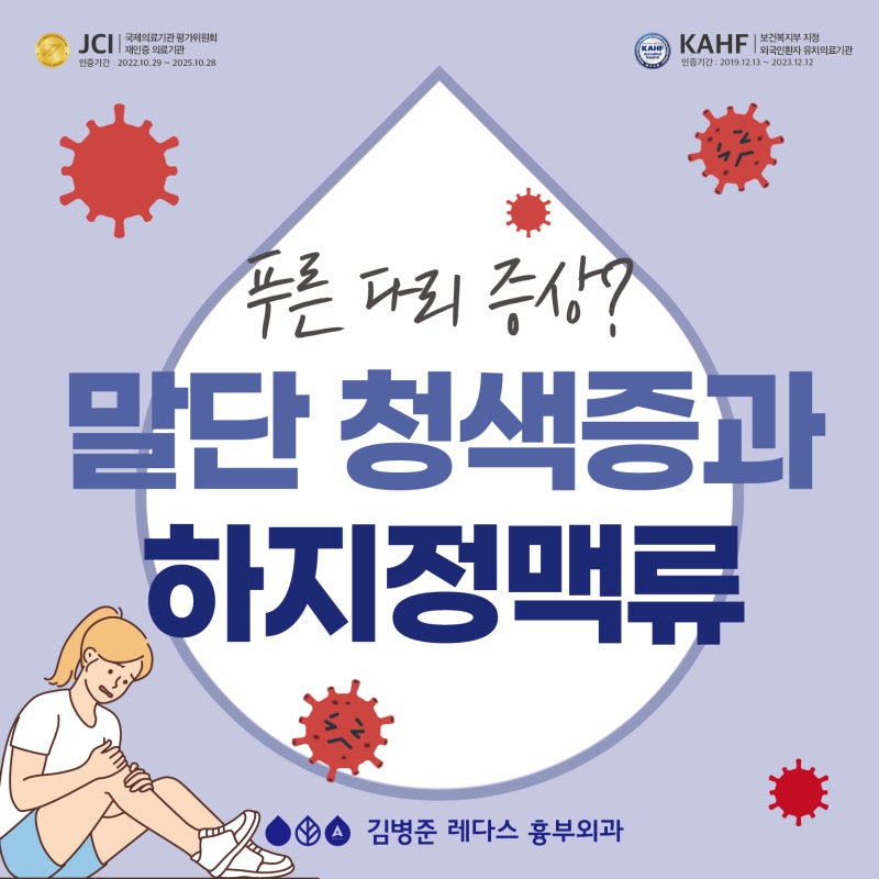 코로나 후 푸른 다리? 말단청색증과 하지정맥류