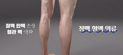 하지정맥류 증상 완화, 이것을 추천합니다 사진 4